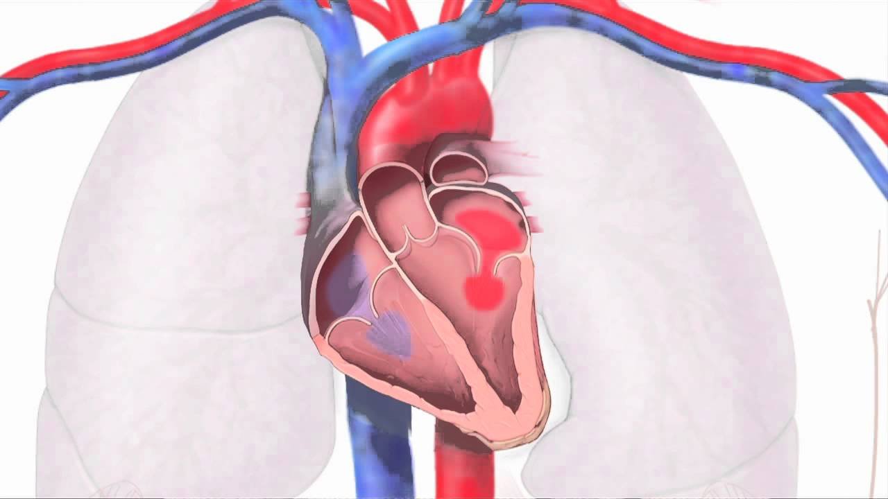 Mitral Kapak Ameliyatı Nedir Koroner Bypass Ameliyatı